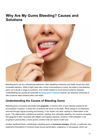 Why Are My Gums Bleeding Causes and Solutions