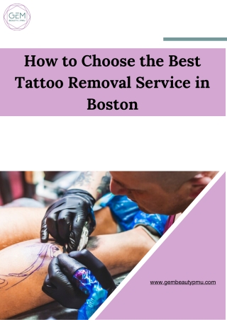 How to Choose the Best Tattoo Removal Service in Boston