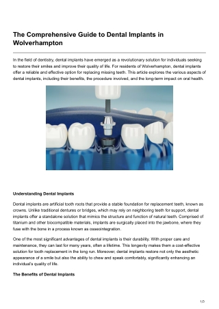 The Comprehensive Guide to Dental Implants in Wolverhampton