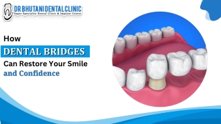 How Dental Bridges Can Restore Your Smile and Confidence?
