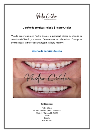 Diseño de sonrisas Toledo | Pedro Citoler