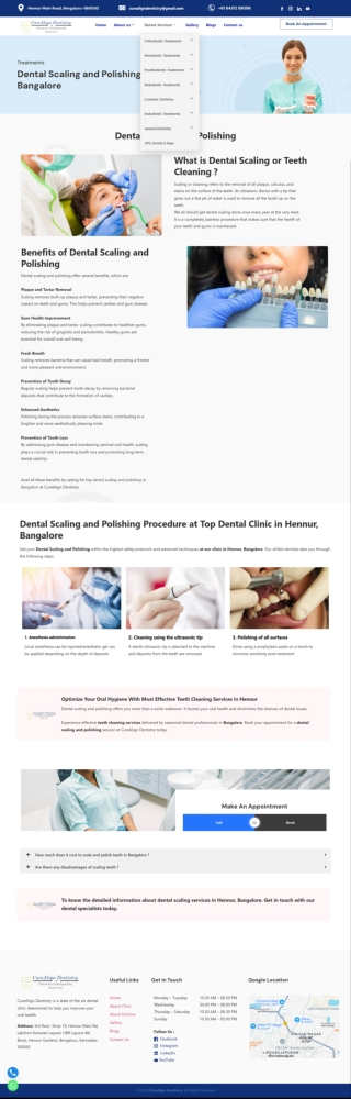 Dental-Scaling-Polishing-in-Hennur-Bangalore-CureAlign