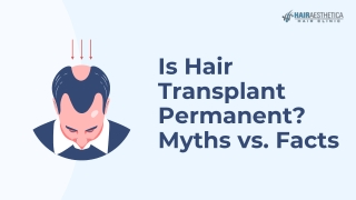Is Hair Transplant Permanent  Myths vs. Facts