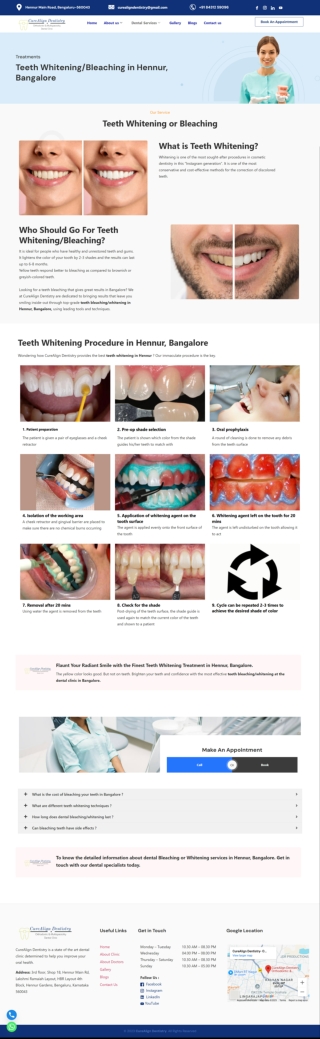 Teeth-Whitening-Bleaching-in-Hennur-Bangalore-CureAlign