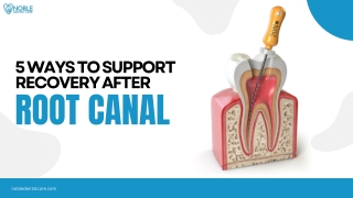 5 Ways to Support Recovery After a Root Canal