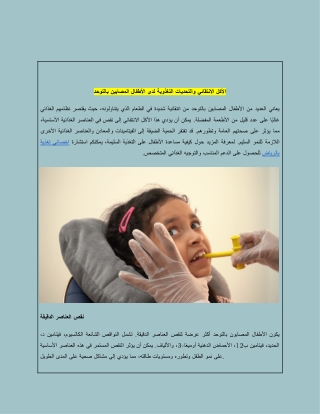 الأكل الانتقائي والتحديات التغذوية لدى الأطفال المصابين بالتوحد