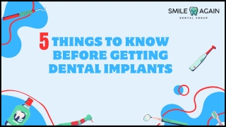 Dental Implants: 5 Things You Should Be Aware Of