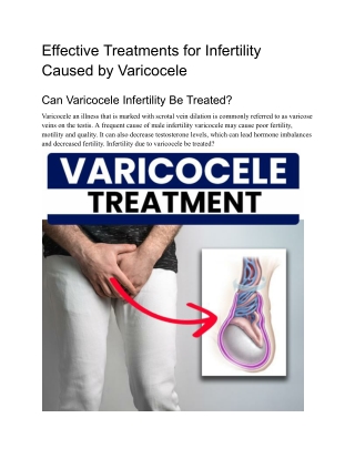 Can Varicocele Infertility Be Treated