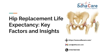 _Hip Replacement Surgery Life Expectancy