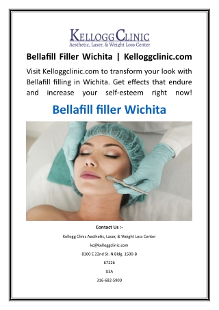 Bellafill Filler Wichita  Kelloggclinic.com