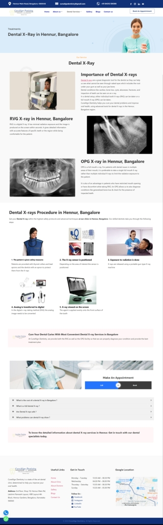 OPG Dental X-Rays in Hennur, Bangalore | CureAlign Dentistry