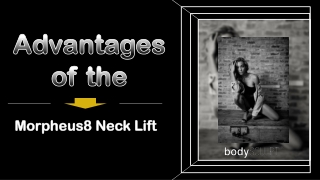 Advantages of the Morpheus8 Neck Lift
