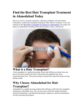 Best Hair Transplant Treatment in Ahmedabad