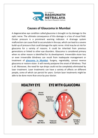 Causes of Glaucoma in Mumbai.docx