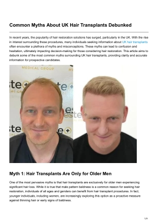 Common Myths About UK Hair Transplants Debunked