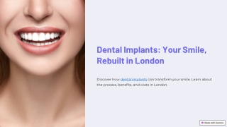 Dental Implants: Your Smile, Rebuilt in London