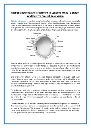 Diabetic Retinopathy Treatment In London What To Expect And How To Protect Your Vision