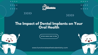 The Impact of Dental Implants on Your Oral Health