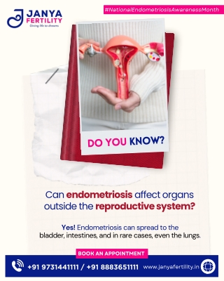 Endometriosis Awareness Month_JanyaFertility_ Best Gynecologist HSR Layout