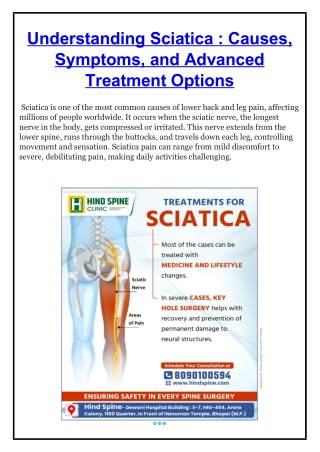Understanding Sciatica - Hind Spine Clinic
