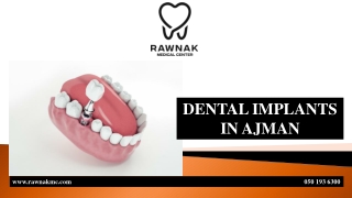 DENTAL IMPLANTS IN AJMAN