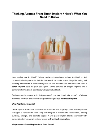 Thinking About a Front Tooth Implant? Here’s What You Need to Know