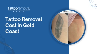 Tattoo Removal Cost in Gold Coast