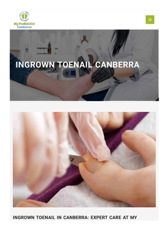 Ingrown Toenail Canberra