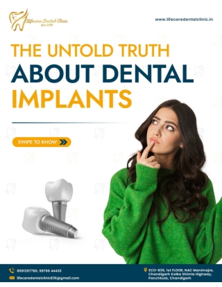 The Untold Truth About Dental Implants - Life Care Dental Clinic