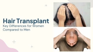 Hair Transplant - Key Differences for Women Compared to Men