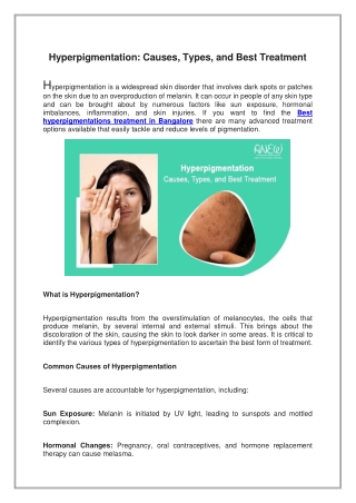 Hyperpigmentation, Causes, Types, and Best Treatment