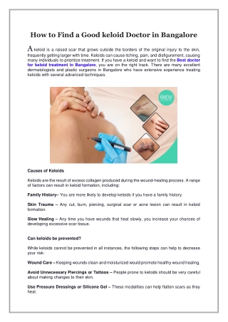How to Find a Good keloid Doctor in Bangalore