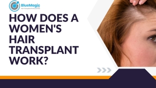 How Does a Women's Hair Transplant Work