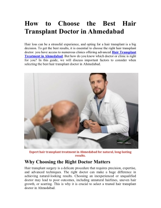 How to Choose the Best Hair Transplant Doctor in Ahmedabad