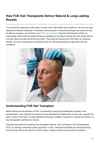How FUE Hair Transplants Deliver Natural & Long-Lasting Results