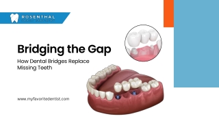 Bridging the Gap: How Dental Bridges Replace Missing Teeth.