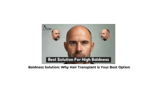 Baldness Treatment- Why Hair Transplant is Your Best Option