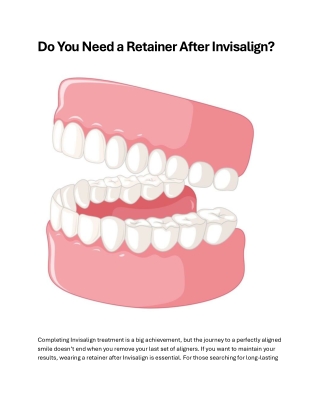 Do You Need a Retainer After Invisalign