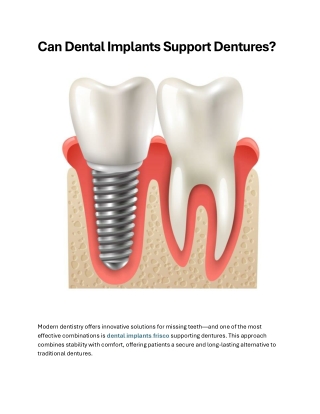 Can Dental Implants Support Dentures