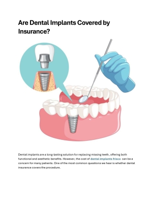 Are Dental Implants Covered by Insurance