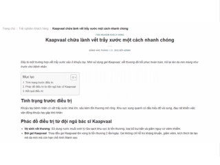 Trải nghiệm khách hàng - Kaapvaal chữa lành vết trầ xước