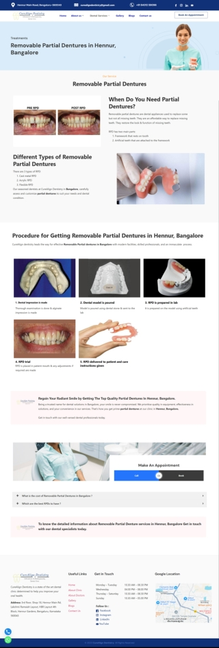 Removable Partial Dentures in Hennur, Bangalore
