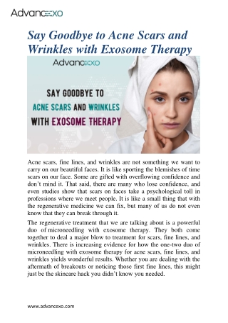 Goodbye to Acne Scars & Wrinkles: how exosome therapy works?