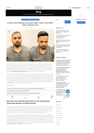 Is Hair Loss Making You Look Older Than Your Wife Here’s What to Do