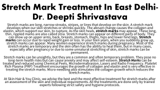 Stretch Mark Treatment In East Delhi-Dr. Deepti Shrivastava