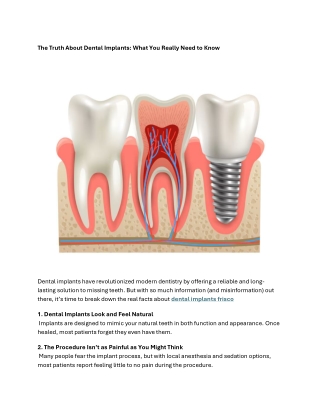 The Truth About Dental Implants What You Really Need to Know