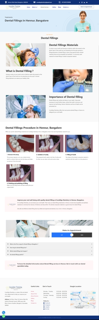 Dental Fillings Treatment in Hennur, Bangalore