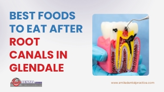 Best Foods to Eat After Root Canals in Glendale