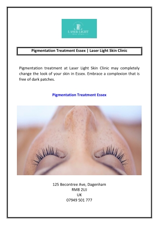 Pigmentation Treatment Essex Laser Light Skin Clinic