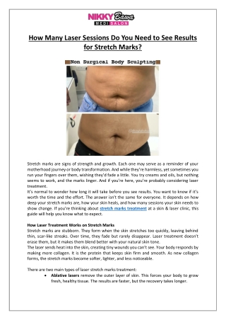Stretch Marks - How Many Laser Sessions Do You Need